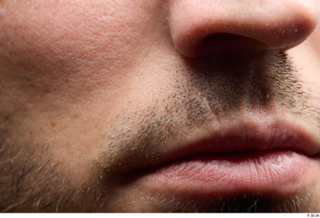 HD Face Skin Dash cheek face lips mouth nose skin…